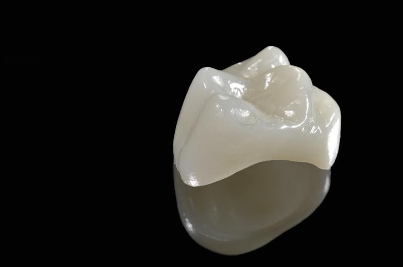 Porcelain Crowns  Sylmar, CA